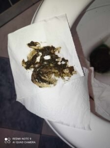 pasozyty w kale przywry